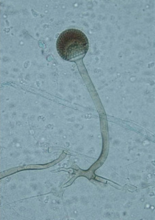 
          Rhizopus microsporus (Brûlure des semis chez le riz)